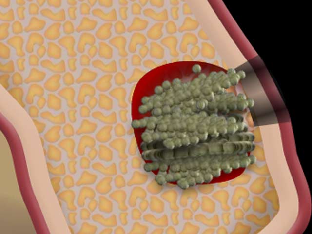 Defektaugmentation Denta Beaute