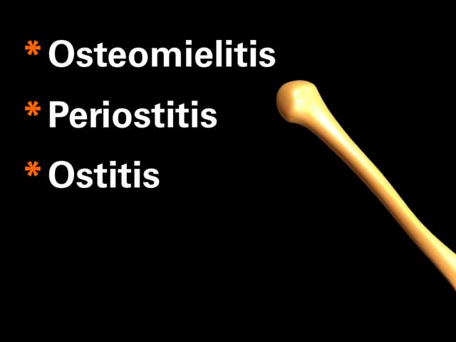 Osteomyelitis - Denta Beaute