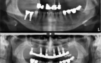 Zahnröntgen Besprechung Fall 3
