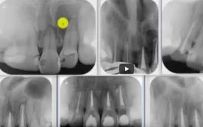 Zahnröntgen Besprechung Fall 5