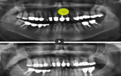 Zahnröntgen Besprechung Fall 6