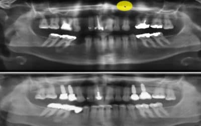 Zahnröntgen Besprechung Fall 7
