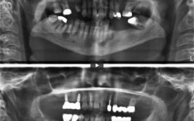 Zahnröntgen Besprechung Fall 8