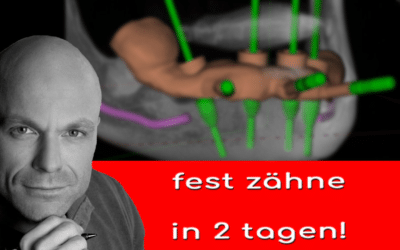 feste Zähne in 2 Tagen?!